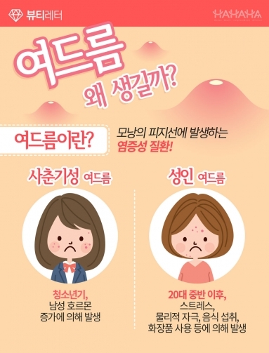 [뷰티&다이어트] 여드름 왜 생길까?