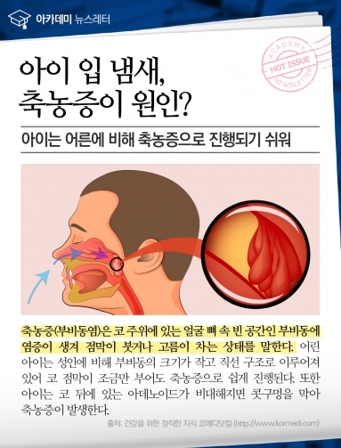 [건강이슈] 아이 입 냄새, 축농증이 원인